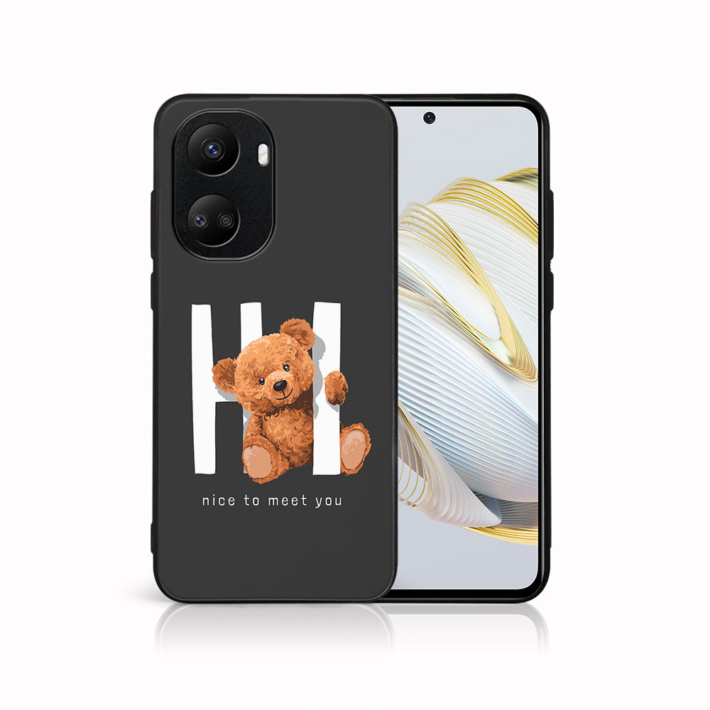 E-shop MY ART Ochranný kryt pre Huawei Nova 10 SE HI (182)