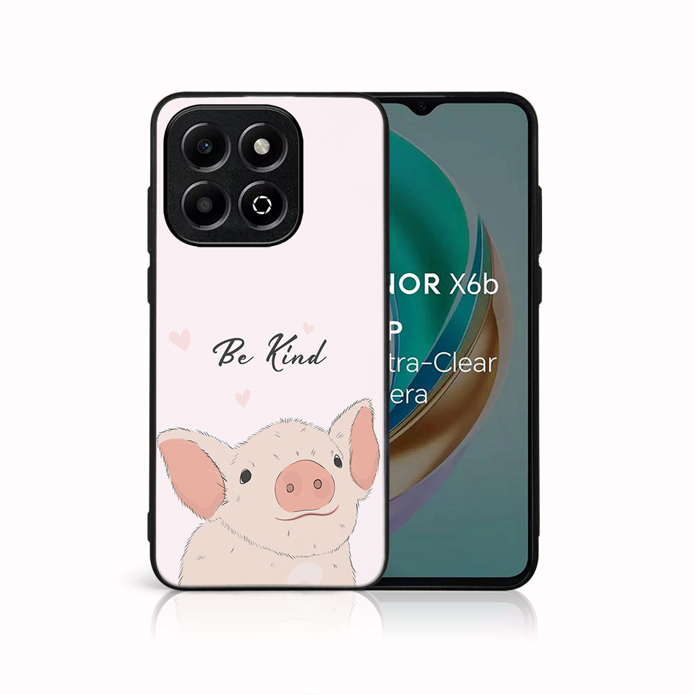 E-shop MY ART Ochranný kryt pre Honor X6b BE KIND (190)