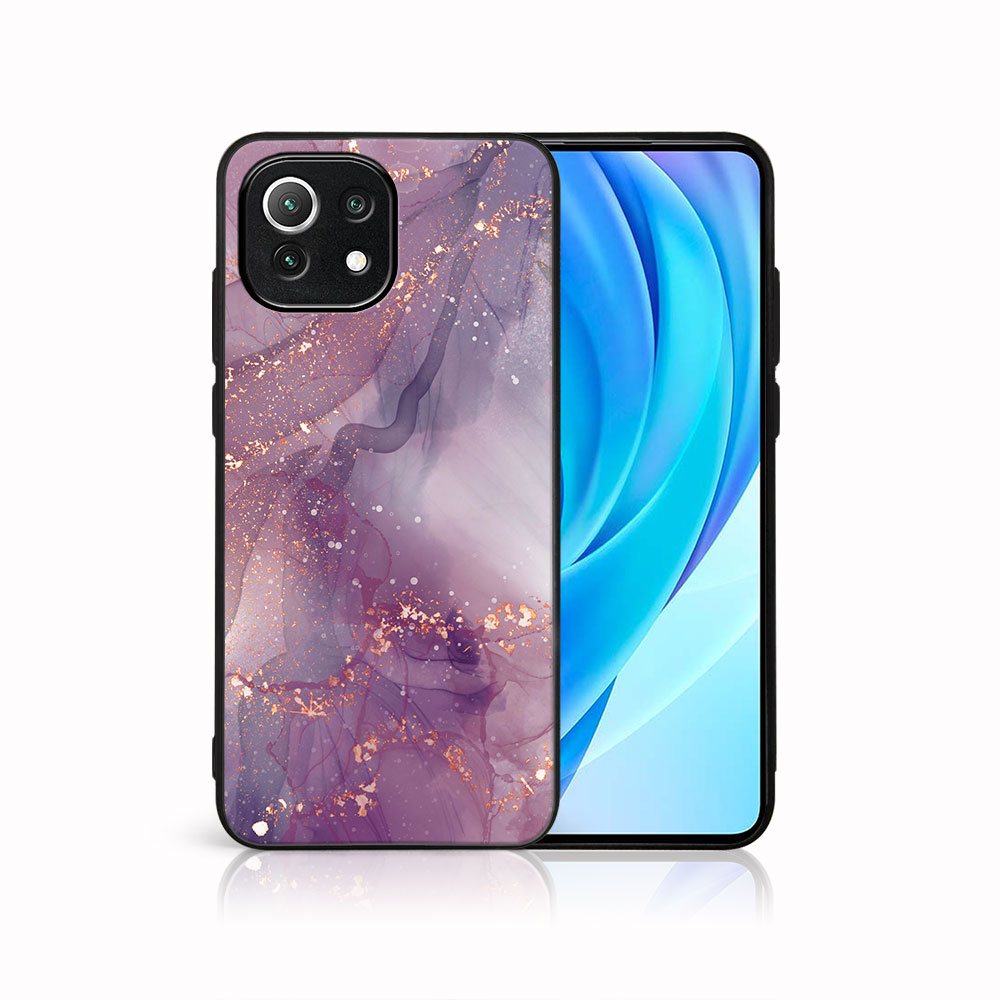 E-shop MY ART Ochranný kryt Xiaomi Mi 11 Lite / 11 Lite 5G / 11 Lite NE 5G -PURPLE (148)